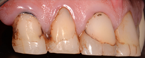 Before image