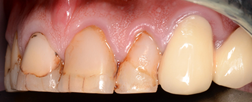 After image