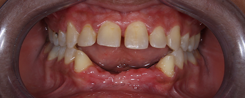 Before image