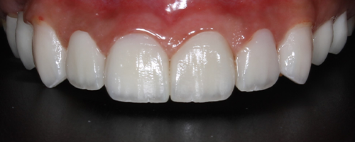 Before image
