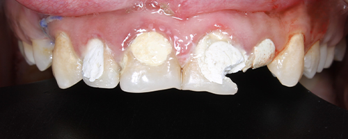 After image