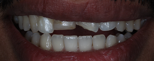 Before image