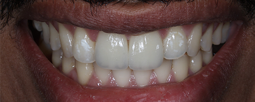 After image