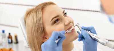 شروط استخدام دعامات الأسنان