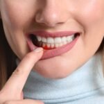 انواع امراض اللثة وطرق علاجها بأحدث التقنيات الطبية