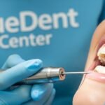 طريقة ازالة الكلس من الاسنان و ما هي أسبابة