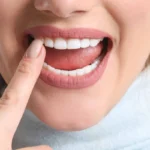 علاج تآكل مينا الأسنان و الضرس من الجانب
