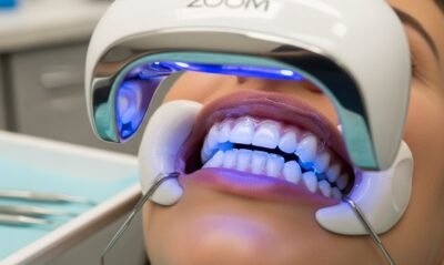 تبييض الاسنان بالزوم في مركز TrueDent لأفضل ابتسامة لامعة