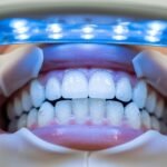 هل تبييض الاسنان بالزوم يستحق التجربة؟ كل ما تحتاج معرفته عن الفوائد, النتائج و الأمان