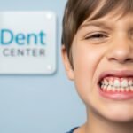 كيف تتجنب مشاكل الفم؟ تعرف على اسباب تقرحات اللثة وطرق الوقاية