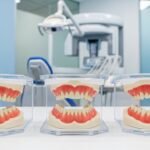 خلع جميع الأسنان وتركيب طقم الأسنان الكامل: الأسباب الطبية، مراحل العلاج، الفرق بين الطقم التقليدي والزراعة